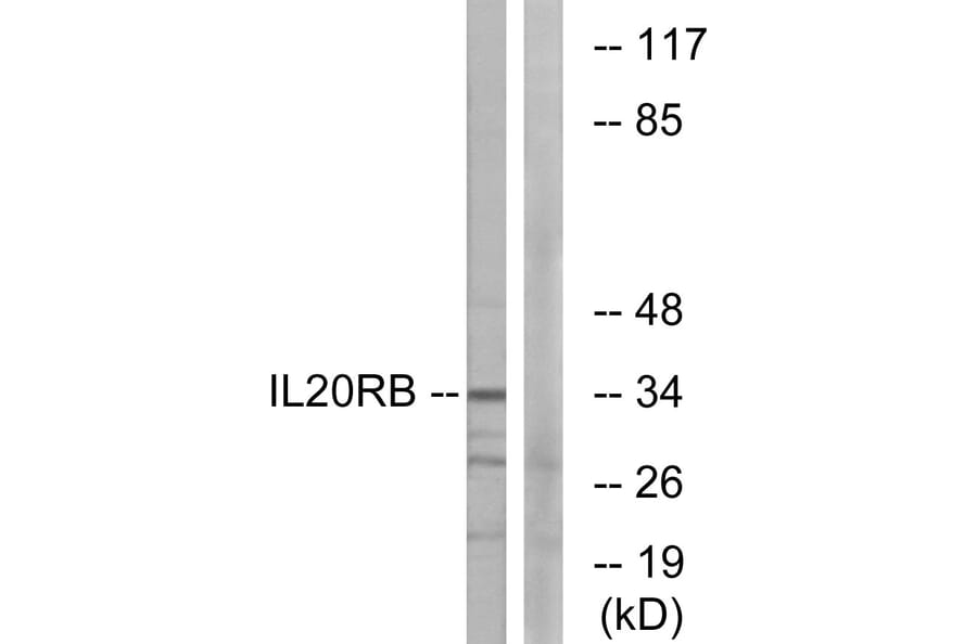 Western Blot - Anti-IL20RB Antibody (C12439) - Antibodies.com