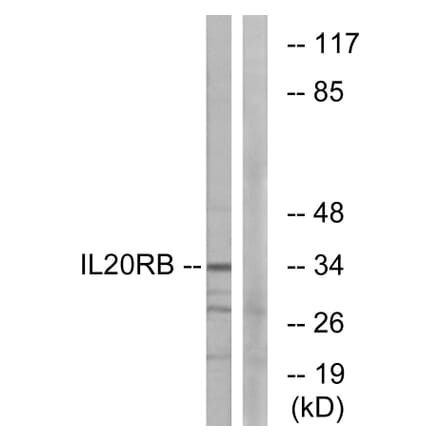 Western Blot - Anti-IL20RB Antibody (C12439) - Antibodies.com