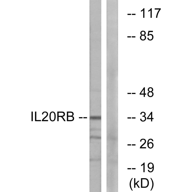 Western Blot - Anti-IL20RB Antibody (C12439) - Antibodies.com