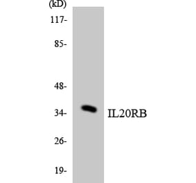 Western Blot - Anti-IL20RB Antibody (R12-2922) - Antibodies.com