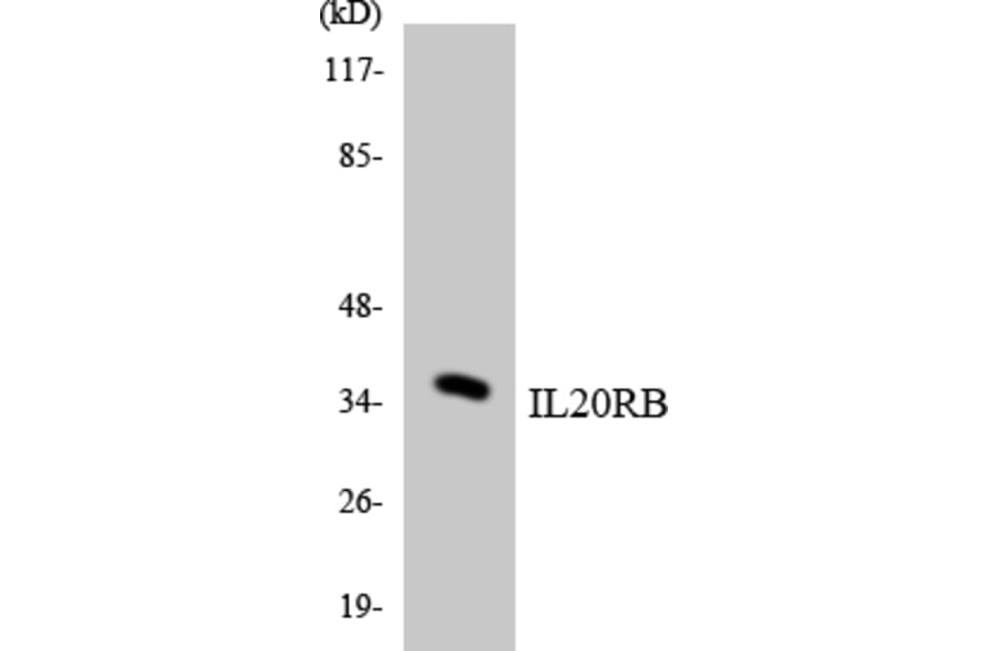 Western Blot - Anti-IL20RB Antibody (R12-2922) - Antibodies.com