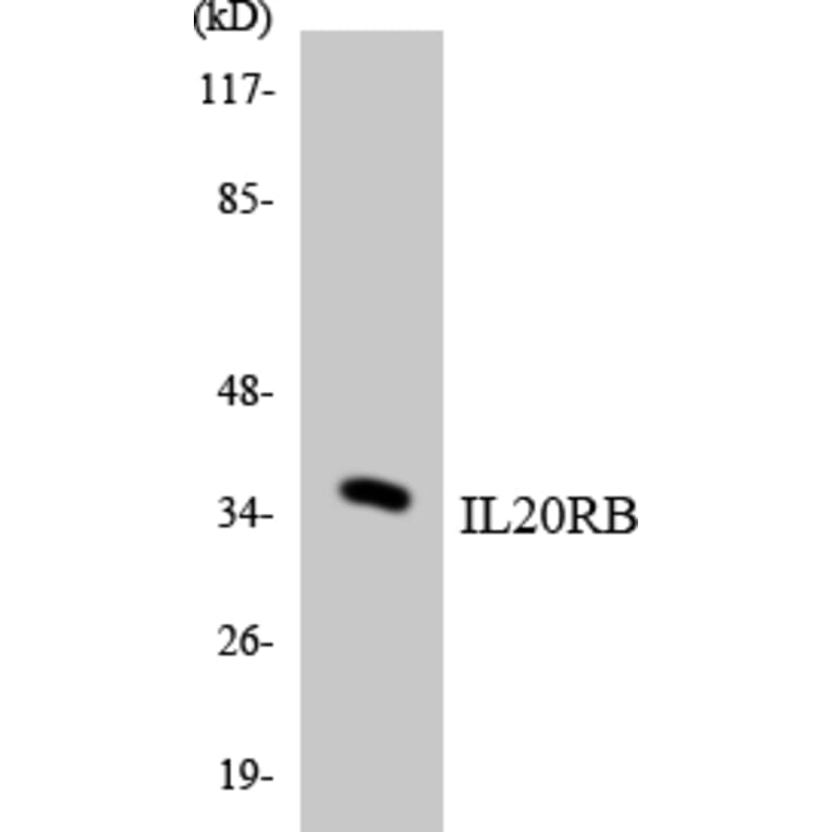 Western Blot - Anti-IL20RB Antibody (R12-2922) - Antibodies.com