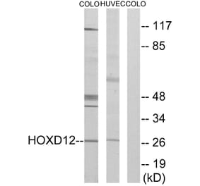 Western Blot - Anti-HOXD12 Antibody (C10555) - Antibodies.com