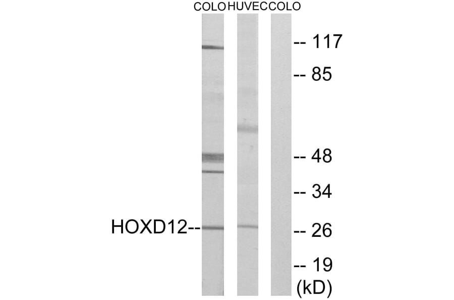 Western Blot - Anti-HOXD12 Antibody (C10555) - Antibodies.com