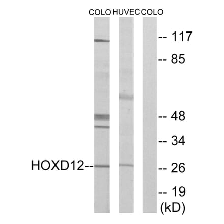 Western Blot - Anti-HOXD12 Antibody (C10555) - Antibodies.com