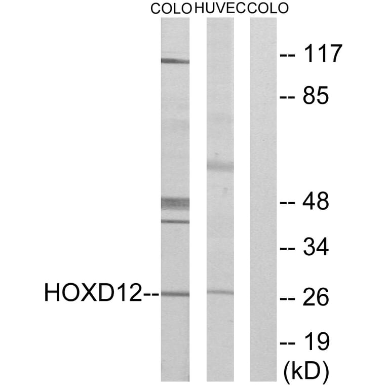 Western Blot - Anti-HOXD12 Antibody (C10555) - Antibodies.com