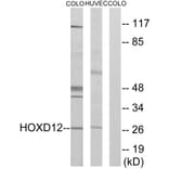 Western Blot - Anti-HOXD12 Antibody (C10555) - Antibodies.com