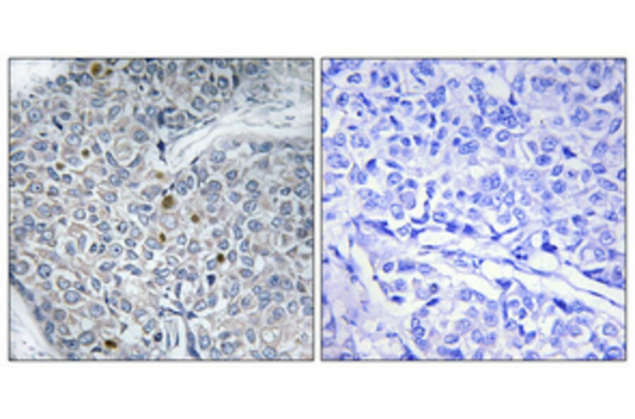 Immunohistochemistry - Anti-HOXD12 Antibody (C10555) - Antibodies.com