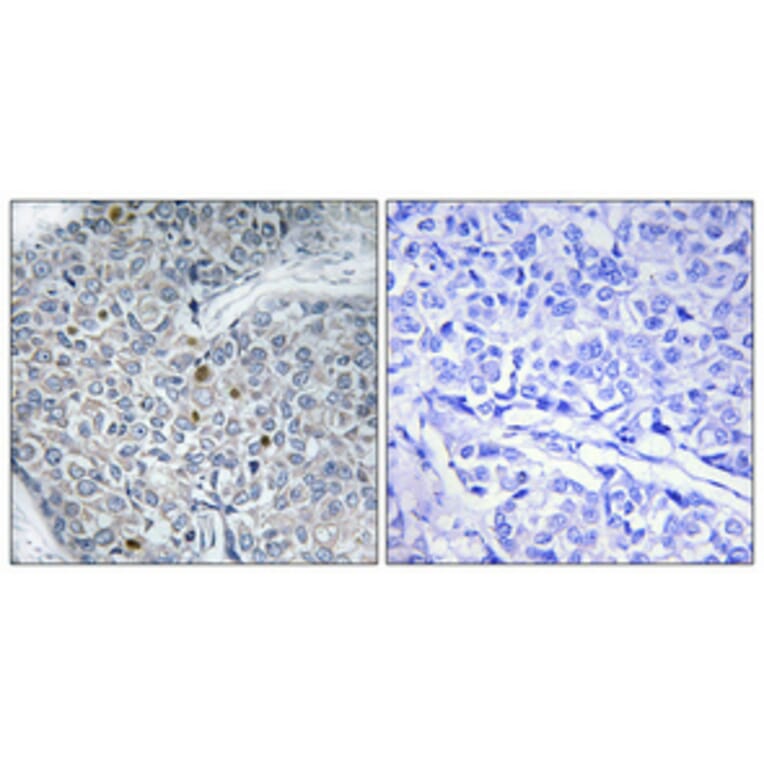 Immunohistochemistry - Anti-HOXD12 Antibody (C10555) - Antibodies.com
