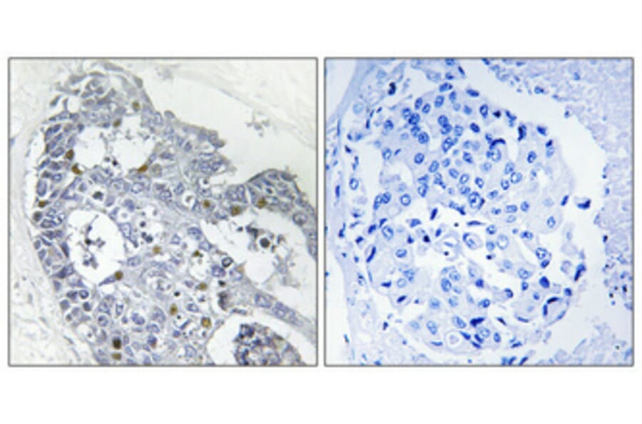 Immunohistochemistry - Anti-HOXD12 Antibody (C10555) - Antibodies.com