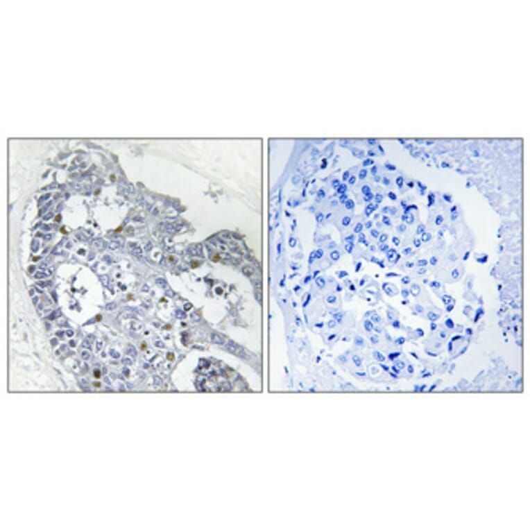 Immunohistochemistry - Anti-HOXD12 Antibody (C10555) - Antibodies.com