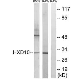 Western Blot - Anti-HOXD10 Antibody (C16318) - Antibodies.com