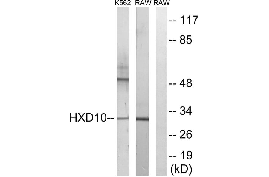 Western Blot - Anti-HOXD10 Antibody (C16318) - Antibodies.com
