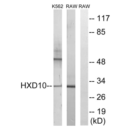 Western Blot - Anti-HOXD10 Antibody (C16318) - Antibodies.com