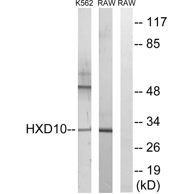 Western Blot - Anti-HOXD10 Antibody (C16318) - Antibodies.com