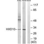 Western Blot - Anti-HOXD10 Antibody (C16318) - Antibodies.com