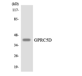 Western Blot - Anti-GPRC5D Antibody (R12-2850) - Antibodies.com