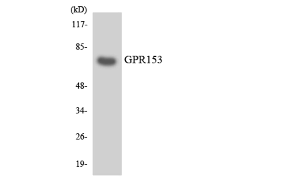 Western Blot - Anti-GPR153 Antibody (R12-2834) - Antibodies.com
