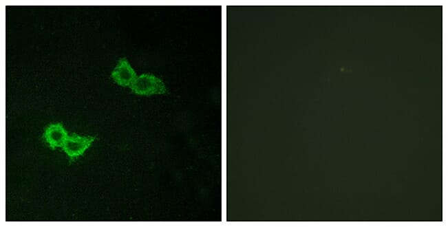Immunofluorescence analysis of HepG2 cells using Anti-GPR150 Antibody. The right hand panel represents a negative control, where the antibody was pre-incubated with the immunising peptide.