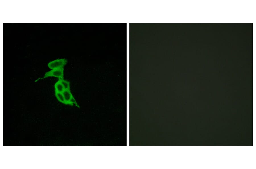 Immunofluorescence - Anti-GPR143 Antibody (G297) - Antibodies.com