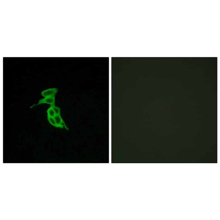 Immunofluorescence - Anti-GPR143 Antibody (G297) - Antibodies.com