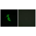 Immunofluorescence - Anti-GPR143 Antibody (G297) - Antibodies.com
