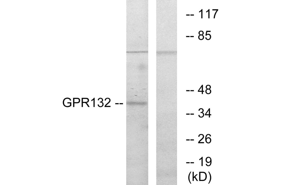 Western Blot - Anti-GPR132 Antibody (G130) - Antibodies.com