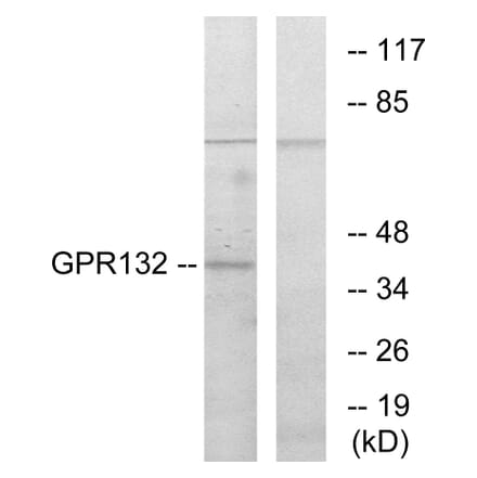 Western Blot - Anti-GPR132 Antibody (G130) - Antibodies.com