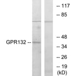 Western Blot - Anti-GPR132 Antibody (G130) - Antibodies.com