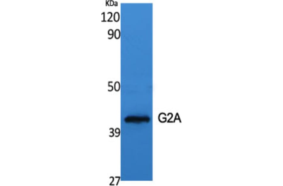 Western Blot - Anti-GPR132 Antibody (G130) - Antibodies.com