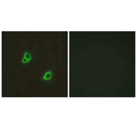 Immunofluorescence - Anti-GPR126 Antibody (G128) - Antibodies.com