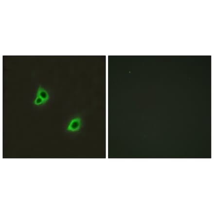 Immunofluorescence - Anti-GPR126 Antibody (G128) - Antibodies.com