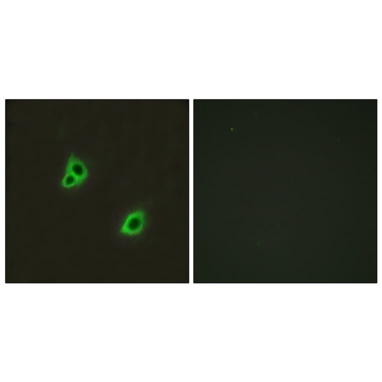Immunofluorescence - Anti-GPR126 Antibody (G128) - Antibodies.com
