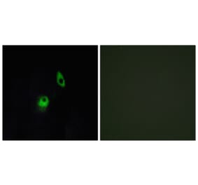 Immunofluorescence - Anti-GPR124 Antibody (G288) - Antibodies.com