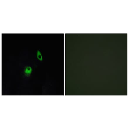 Immunofluorescence - Anti-GPR124 Antibody (G288) - Antibodies.com