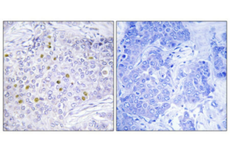 Immunohistochemistry - Anti-GCN5L2 Antibody (C11438) - Antibodies.com