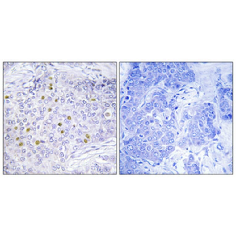 Immunohistochemistry - Anti-GCN5L2 Antibody (C11438) - Antibodies.com