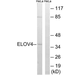 Western Blot - Anti-ELOVL4 Antibody (C15620) - Antibodies.com