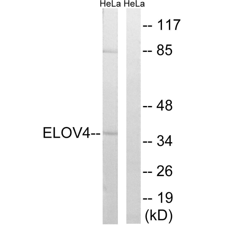 Western Blot - Anti-ELOVL4 Antibody (C15620) - Antibodies.com
