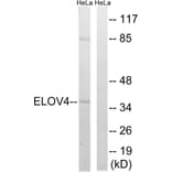 Western Blot - Anti-ELOVL4 Antibody (C15620) - Antibodies.com
