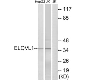 Western Blot - Anti-ELOVL1 Antibody (C15617) - Antibodies.com