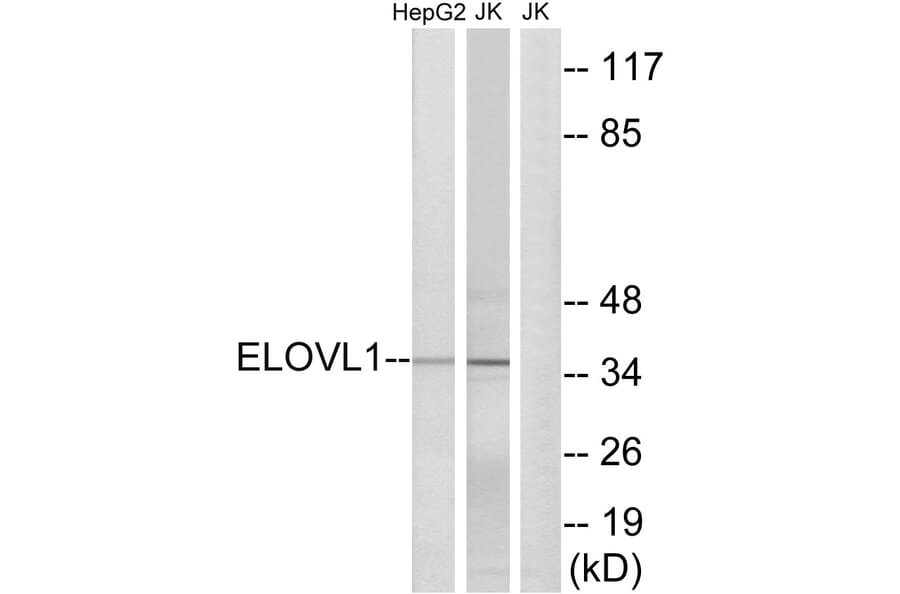 Western Blot - Anti-ELOVL1 Antibody (C15617) - Antibodies.com