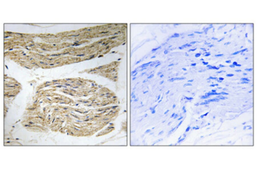 Immunohistochemistry - Anti-ELOVL1 Antibody (C15617) - Antibodies.com