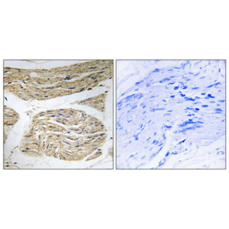 Immunohistochemistry - Anti-ELOVL1 Antibody (C15617) - Antibodies.com