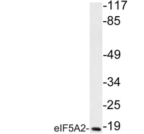 Western Blot - Anti-eIF5A2 Antibody (R12-2128) - Antibodies.com