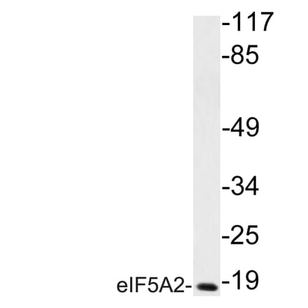 Western Blot - Anti-eIF5A2 Antibody (R12-2128) - Antibodies.com