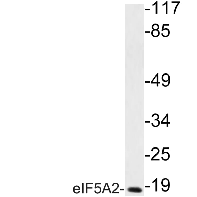 Western Blot - Anti-eIF5A2 Antibody (R12-2128) - Antibodies.com