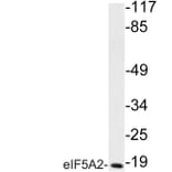 Western Blot - Anti-eIF5A2 Antibody (R12-2128) - Antibodies.com