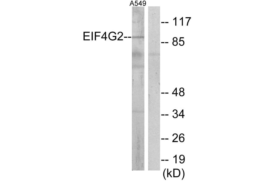 Western Blot - Anti-EIF4G2 Antibody (C13062) - Antibodies.com