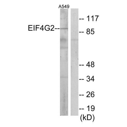 Western Blot - Anti-EIF4G2 Antibody (C13062) - Antibodies.com